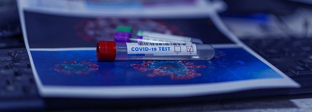 Második generációs szerológiai koronavírus gyorstesztek érkeztek Magyarországra