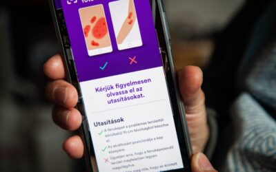 Digitális forradalom az egészségügyben: saját otthonunkból váltak diagnosztizálhatóvá a bőrbetegségek